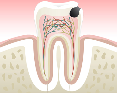 Dentiste Asnières Gennevilliers