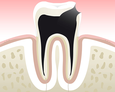 Dentiste Asnières Gennevilliers