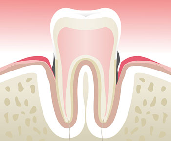 Dentiste Asnières Gennevilliers