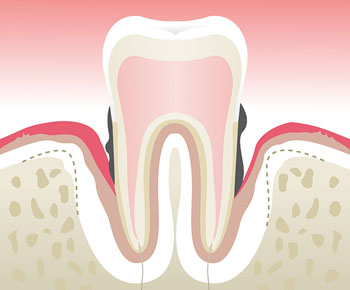 Dentiste Asnières Gennevilliers